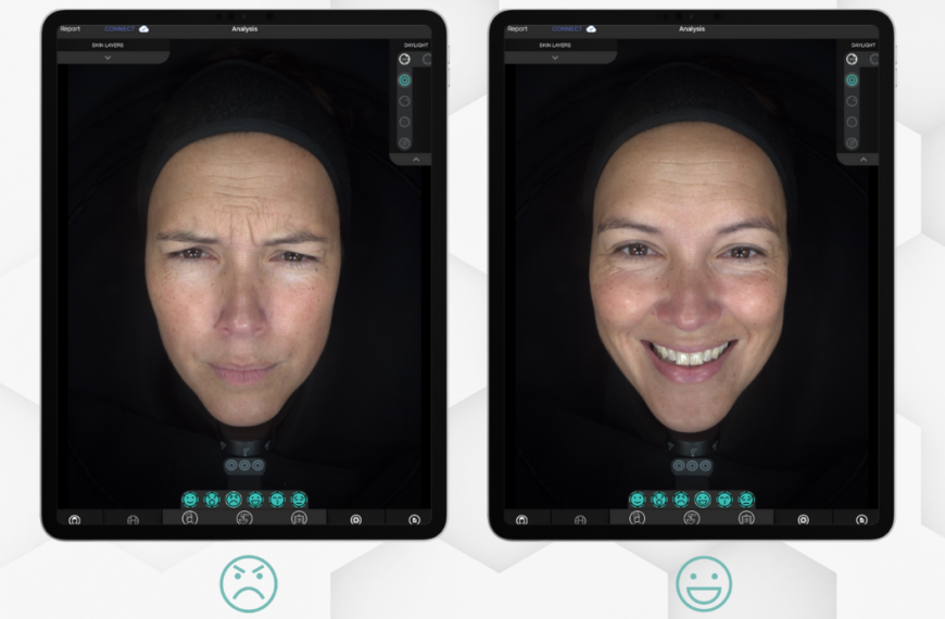 Nueva función en Sylton Observ 520x – Expresiones Faciales