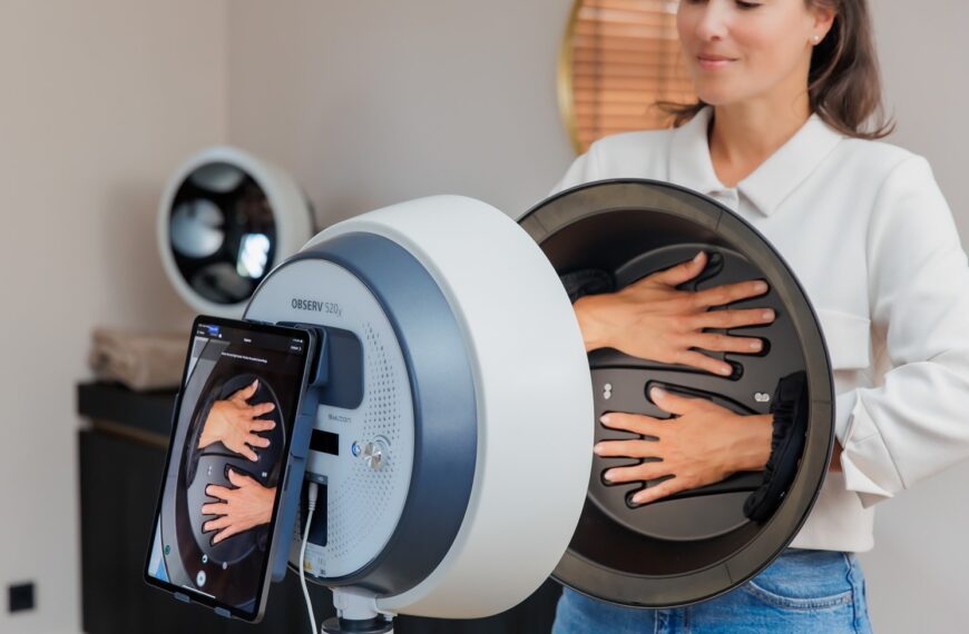 Nuevos KITS de Extensión SYLTON OBSERV