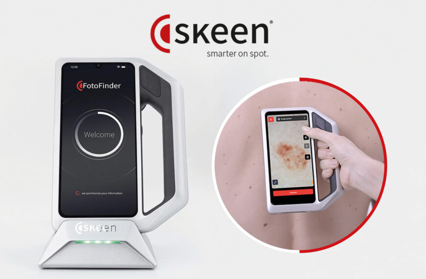 SKEEN Fotofinder Imágenes inigualables en dermatoscopia y tricoscopia