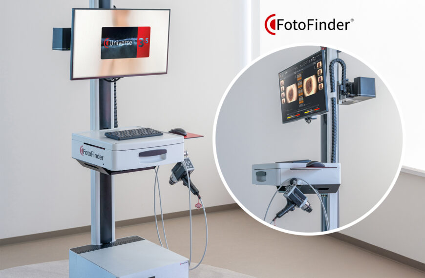 Fotofinder ATBM Master Dermatoscopia corporal total
