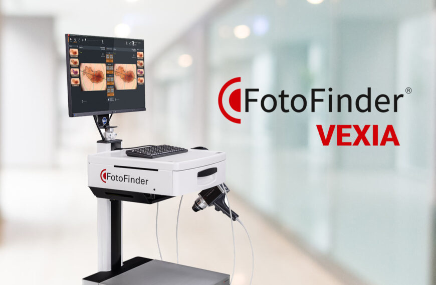 Fotofinder VEXIA videodermatoscopia
